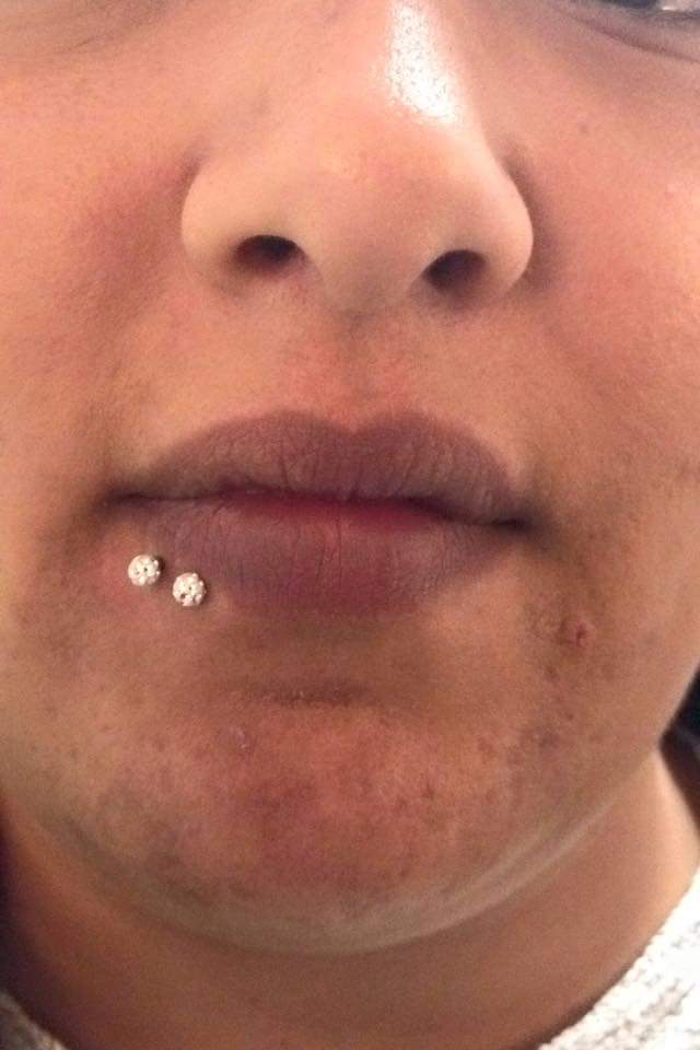 Diamond Studded Under Lip Piercing